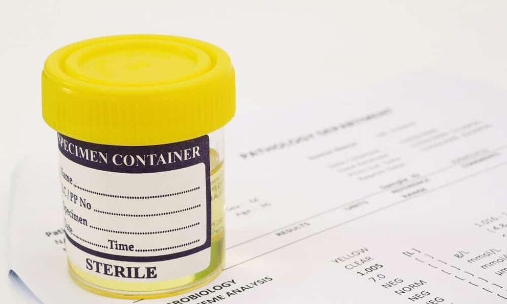 Před užíváním antibiotik musíte udělat test moči